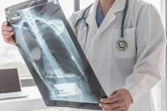A doctor examines an X-ray image, highlighting critical details related to bone cancer surgery options.