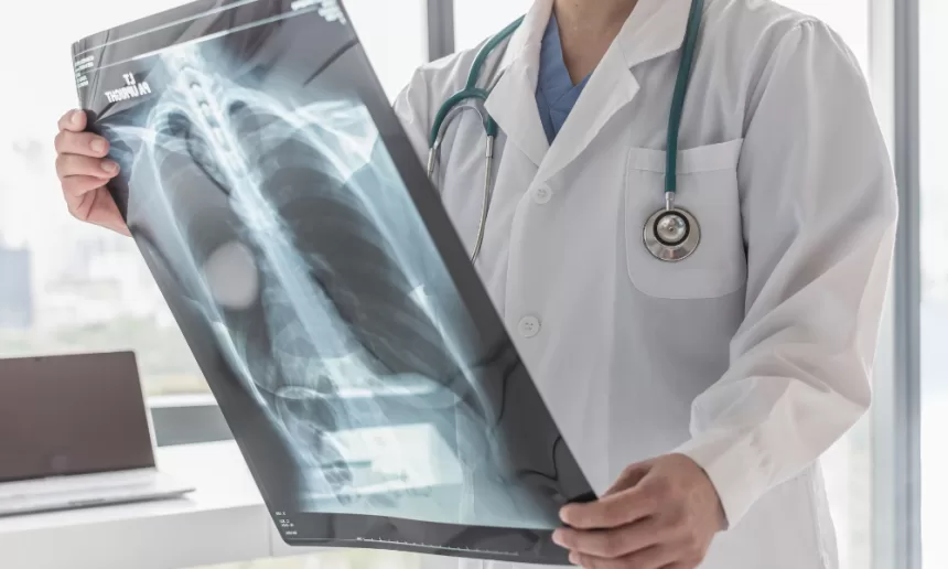 A doctor examines an X-ray image, highlighting critical details related to bone cancer surgery options.