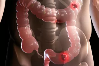 A woman gently rests her hands on her stomach, symbolizing strength and resilience during her ovarian cancer surgery journey.