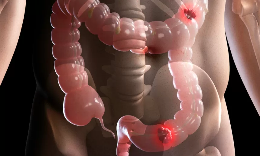 A woman gently rests her hands on her stomach, symbolizing strength and resilience during her ovarian cancer surgery journey.