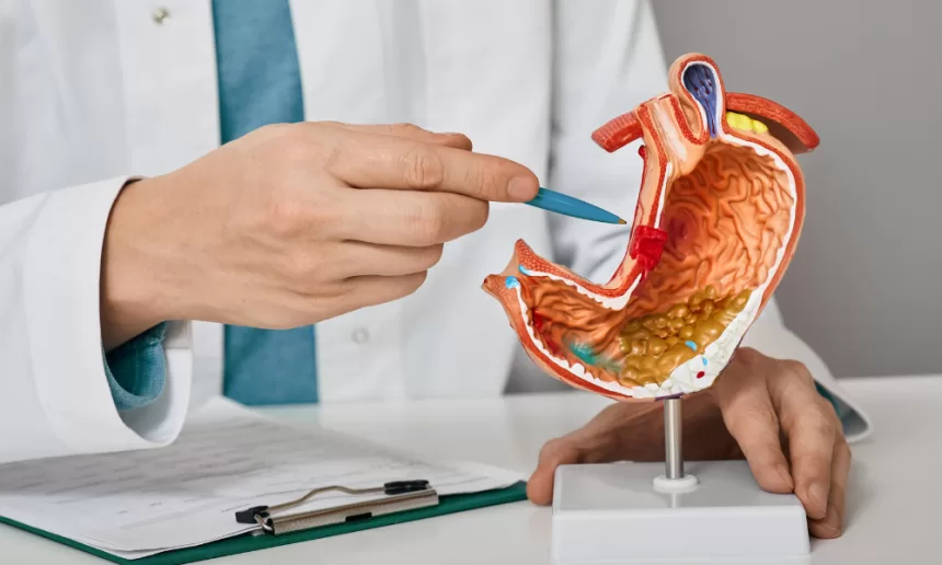 A doctor presents a stomach model, illustrating differences between gastric sleeve and gastric bypass procedures.
