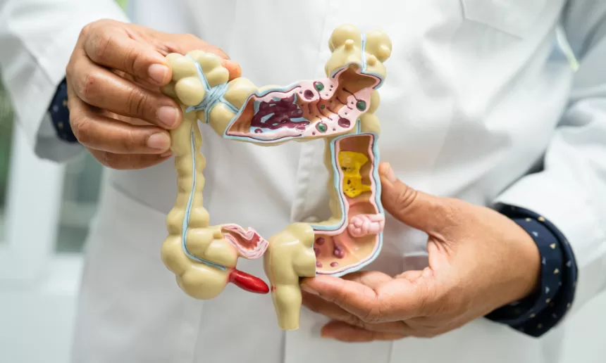 Illustration of a healthy gut with icons representing probiotics, such as yogurt, supplements, and bacteria, emphasizing gut health.