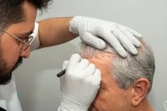 Hair transplant surgery cost