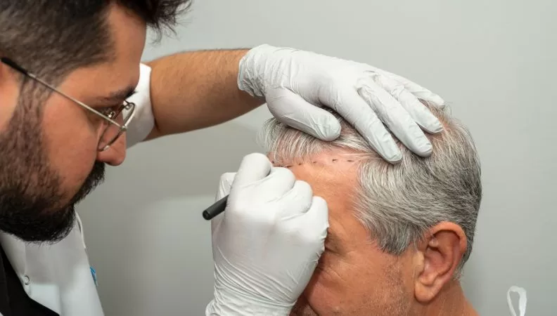 Hair transplant surgery cost