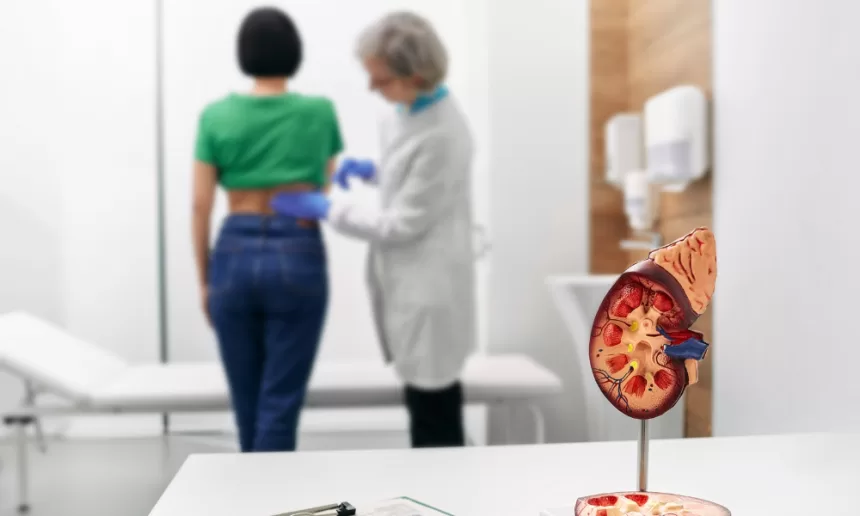 A woman stands beside a detailed model of a human kidney, illustrating the effects of hydronephrosis.