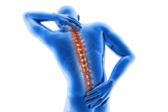 Iraqi patient consulting spine surgeon in India for affordable back surgery treatment