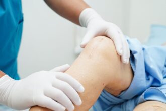 Knee replacement surgery cost discussion with doctor and patient