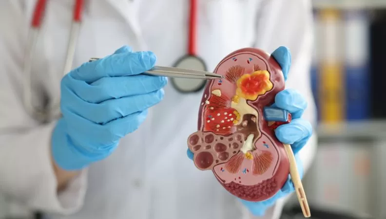 Laparoscopic nephrectomy benefits