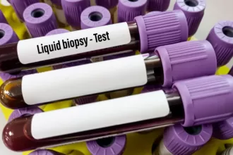 Liquid Biopsy for Cancer Detection