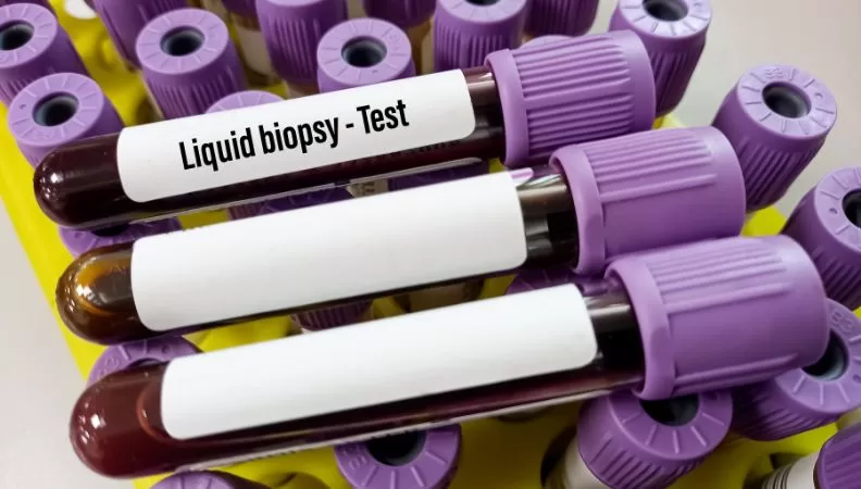 Liquid Biopsy for Cancer Detection
