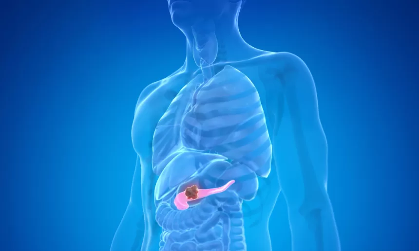 Illustration of the human body with the liver highlighted, emphasizing its role in pancreatic cancer surgery.