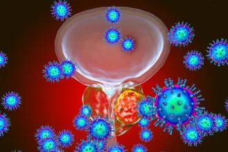 Prostate Health Prevention