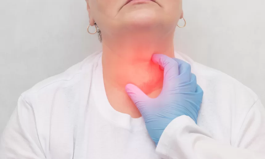A woman showing a red rash on her neck, a possible side effect following thyroid cancer surgery.