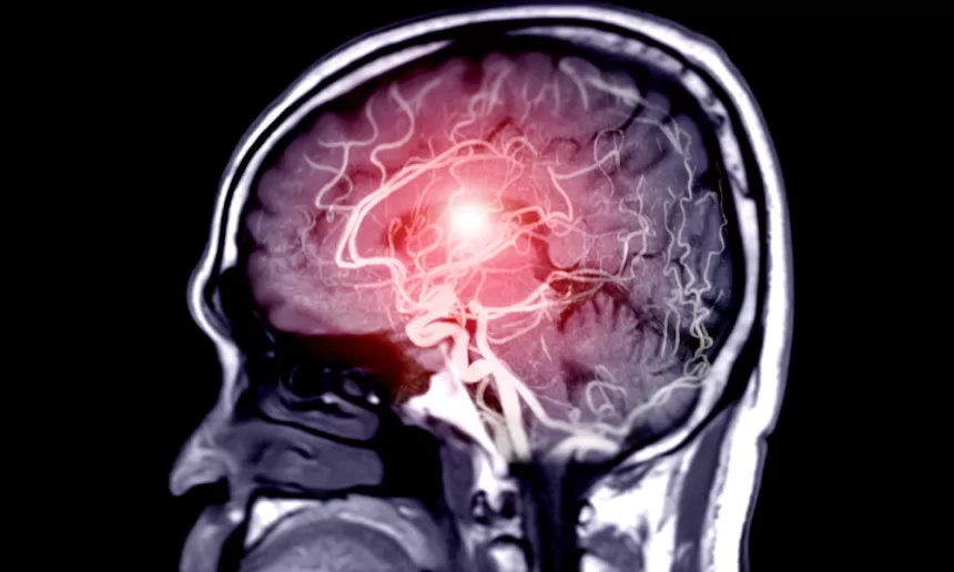 Step-by-step guide on how to detect brain tumor symptoms at home.