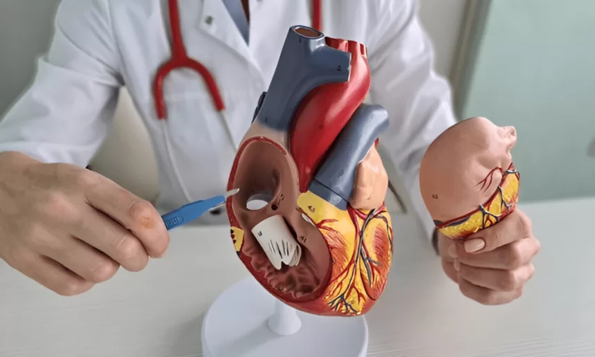 Illustration of mitral valve replacement surgery showing a surgeon implanting a mechanical valve in a human heart.