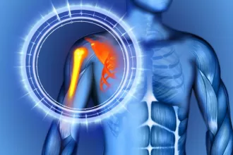 permanent restrictions after shoulder surgery