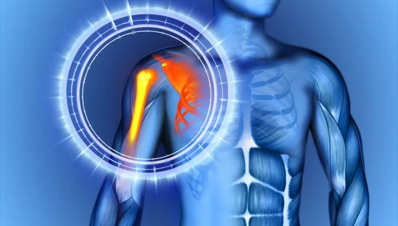 permanent restrictions after shoulder surgery