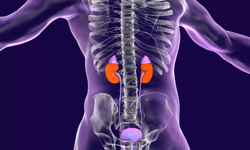 A medical procedure showing renal angioplasty and stenting, with a catheter inserted to widen a narrowed renal artery and place a stent.