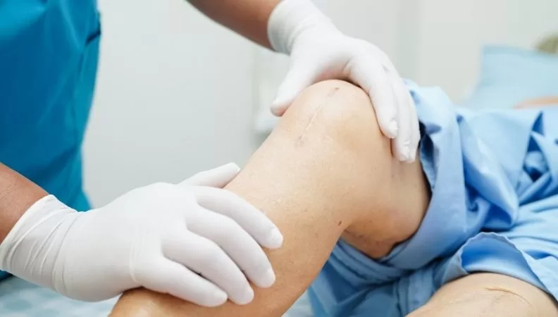success rate of knee replacement in india